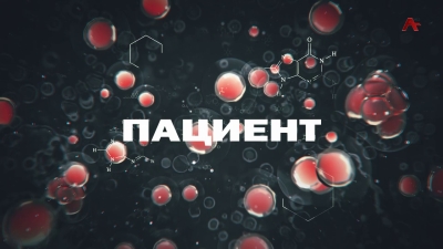 Пациент. Варикозное расширение вен нижних конечностей. Флеболог Андрей Вохмянин